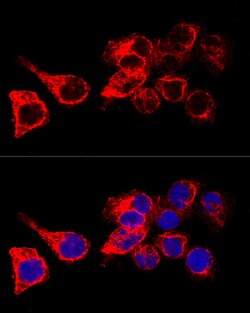 Invitrogen Cytokeratin 17 Polyclonal Antibody 100 &mu;L; Unconjugated:Antibodies,