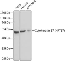 Invitrogen Cytokeratin 17 Polyclonal Antibody 100 &mu;L; Unconjugated:Antibodies,