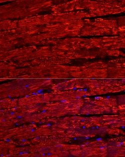 Invitrogen BNP Polyclonal Antibody 100 &mu;L; Unconjugated:Antibodies,