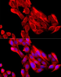 Invitrogen BNP Polyclonal Antibody 100 &mu;L; Unconjugated:Antibodies,