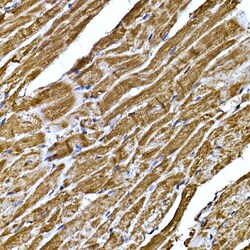 Invitrogen BNP Polyclonal Antibody 100 &mu;L; Unconjugated:Antibodies,