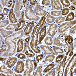 Invitrogen BNP Polyclonal Antibody 100 &mu;L; Unconjugated:Antibodies,