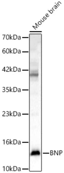 Invitrogen BNP Polyclonal Antibody 100 &mu;L; Unconjugated:Antibodies,