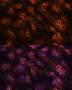 Invitrogen MEK7 Polyclonal Antibody 100 &mu;L; Unconjugated:Antibodies,