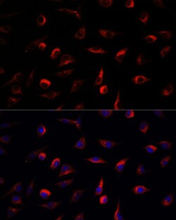 Invitrogen MEK7 Polyclonal Antibody 100 &mu;L; Unconjugated:Antibodies,