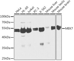 Invitrogen MEK7 Polyclonal Antibody 100 &mu;L; Unconjugated:Antibodies,