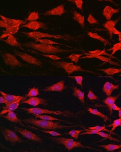 Invitrogen p70 S6 Kinase Polyclonal Antibody 100 &mu;L; Unconjugated:Antibodies,