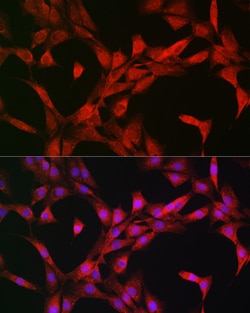 Invitrogen p70 S6 Kinase Polyclonal Antibody 100 &mu;L; Unconjugated:Antibodies,