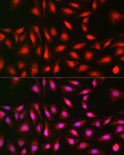 Invitrogen p70 S6 Kinase Polyclonal Antibody 100 &mu;L; Unconjugated:Antibodies,