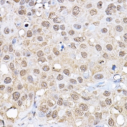 Invitrogen p70 S6 Kinase Polyclonal Antibody 100 &mu;L; Unconjugated:Antibodies,