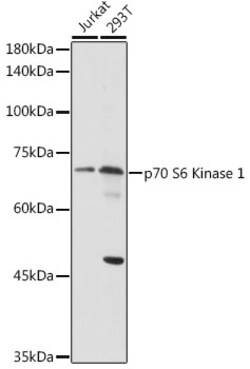 Invitrogen p70 S6 Kinase Polyclonal Antibody 100 &mu;L; Unconjugated:Antibodies,
