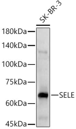 Invitrogen CD62E (E-selectin) Polyclonal Antibody 100 &mu;L; Unconjugated:Antibodies,