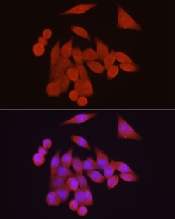 Invitrogen VDR Polyclonal Antibody 100 &mu;L; Unconjugated:Antibodies,