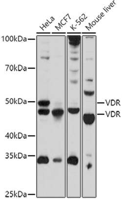Invitrogen VDR Polyclonal Antibody 100 &mu;L; Unconjugated:Antibodies,