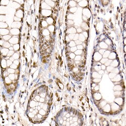 Invitrogen PRMT4 Polyclonal Antibody 100 &mu;L; Unconjugated:Antibodies,