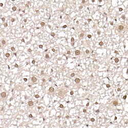 Invitrogen PRMT4 Polyclonal Antibody 100 &mu;L; Unconjugated:Antibodies,