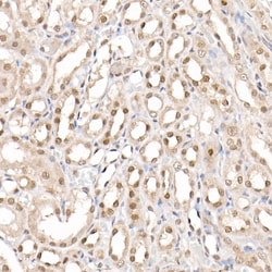 Invitrogen PRMT4 Polyclonal Antibody 100 &mu;L; Unconjugated:Antibodies,