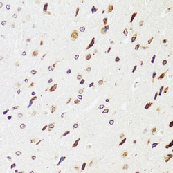 Invitrogen EDF1 Polyclonal Antibody 100 &mu;L; Unconjugated:Antibodies,