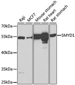 Invitrogen SMYD1 Polyclonal Antibody 100 &mu;L; Unconjugated:Antibodies,