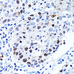 Invitrogen UHRF1 Polyclonal Antibody 100 &mu;L; Unconjugated:Antibodies,