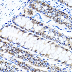 Invitrogen UHRF1 Polyclonal Antibody 100 &mu;L; Unconjugated:Antibodies,