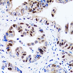 Invitrogen UHRF1 Polyclonal Antibody 100 &mu;L; Unconjugated:Antibodies,