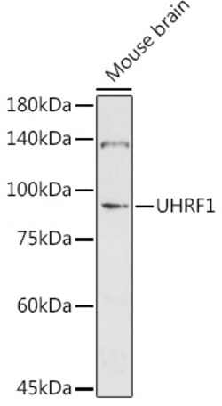 Invitrogen UHRF1 Polyclonal Antibody 100 &mu;L; Unconjugated:Antibodies,
