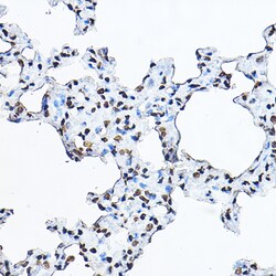 Invitrogen Histone H3.1t Polyclonal Antibody 100 &mu;L | Buy Online | Invitrogen&trade; | Fisher Scientific