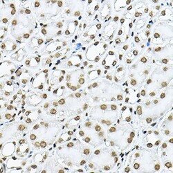 Invitrogen Histone H3.1t Polyclonal Antibody 100 &mu;L | Buy Online | Invitrogen&trade; | Fisher Scientific