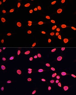 Invitrogen H3K9me1 Polyclonal Antibody 100 &mu;L; Unconjugated:Antibodies,
