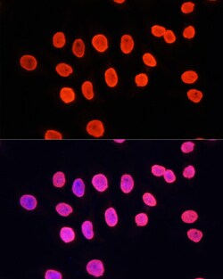 Invitrogen H3K9me1 Polyclonal Antibody 100 &mu;L; Unconjugated:Antibodies,