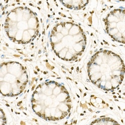 Invitrogen H3K9me1 Polyclonal Antibody 100 &mu;L; Unconjugated:Antibodies,