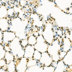 Invitrogen H3K9me1 Polyclonal Antibody 100 &mu;L; Unconjugated:Antibodies,