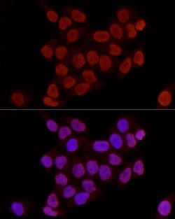 Invitrogen H3K27me2 Polyclonal Antibody 100 &mu;L; Unconjugated:Antibodies,