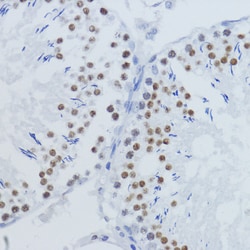 Invitrogen H3K36me2 Polyclonal Antibody 100 &mu;L; Unconjugated:Antibodies,