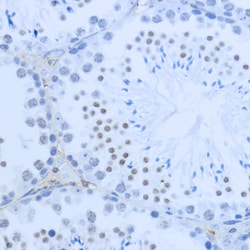 Invitrogen H3K36me2 Polyclonal Antibody 100 &mu;L; Unconjugated:Antibodies,