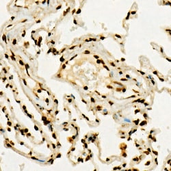 Invitrogen H3K36me3 Polyclonal Antibody, ChIP-Verified 100 &mu;L; Unconjugated:Anticuerpos