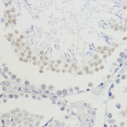 H4K20me3 Polyclonal Antibody, Invitrogen 100 &mu;L; Unconjugated:Antibodies,