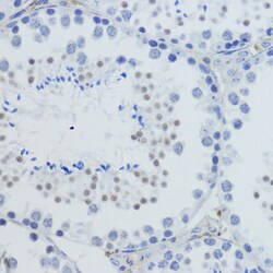 H4K20me3 Polyclonal Antibody, Invitrogen 100 &mu;L; Unconjugated:Antibodies,
