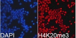 H4K20me3 Polyclonal Antibody, Invitrogen 100 &mu;L; Unconjugated:Antibodies,