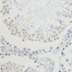 H4K20me3 Polyclonal Antibody, Invitrogen 100 &mu;L; Unconjugated:Antibodies,
