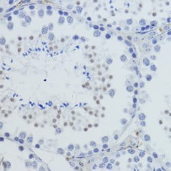 H4K20me3 Polyclonal Antibody, Invitrogen 100 &mu;L; Unconjugated:Antibodies,