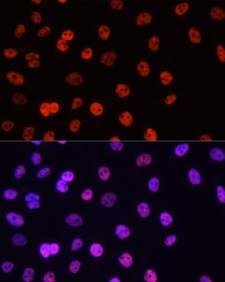 Invitrogen H3R17me2a Polyclonal Antibody 100 &mu;L; Unconjugated:Antibodies,