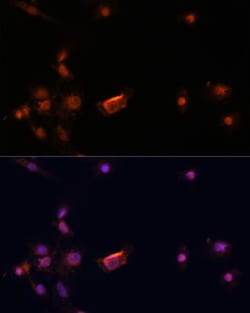 Invitrogen BRCA2 Polyclonal Antibody 100 &mu;L | Buy Online | Invitrogen&trade; | Fisher Scientific