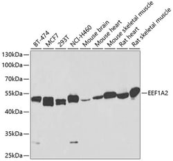Invitrogen EEF1A2 Polyclonal Antibody 100 &mu;L; Unconjugated:Antibodies,