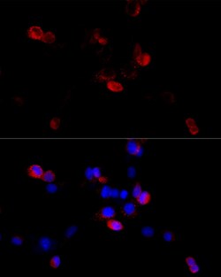 Invitrogen Filamin B Polyclonal Antibody 100 &mu;L; Unconjugated:Antibodies,