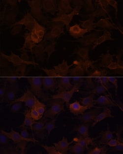 Invitrogen Filamin B Polyclonal Antibody 100 &mu;L; Unconjugated:Antibodies,