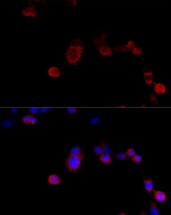 Invitrogen Filamin B Polyclonal Antibody 100 &mu;L; Unconjugated:Antibodies,