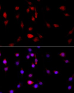 Invitrogen Filamin B Polyclonal Antibody 100 &mu;L; Unconjugated:Antibodies,