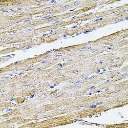 Invitrogen Filamin B Polyclonal Antibody 100 &mu;L; Unconjugated:Antibodies,